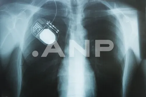 How a Delft semiconductor could supposedly cure diseases — but watch the hype